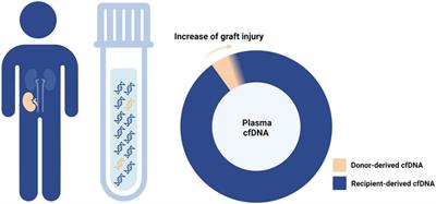 Donor-Derived Cell-Free DNA: Attractive Biomarker Seeks a Context of Use